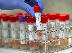 342 новых случая, 15 летальных исходов: сегодняшние данные по ковиду