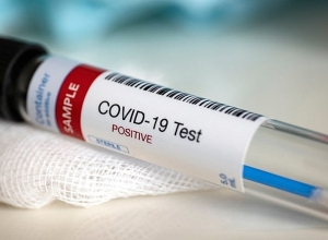 Կովիդի 1 նոր դեպք է հաստատվել Հայաստանում