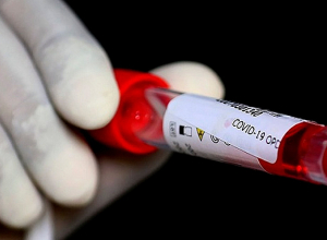 Количество новых подтверждённых случаев удвоилось: данные по коронавирусу за прошлую неделю