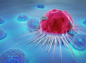 Քաղցկեղը կանխարգելելու 10 խորհուրդ