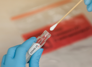 22 новых случаев ковида и 1 смерть: данные за неделю