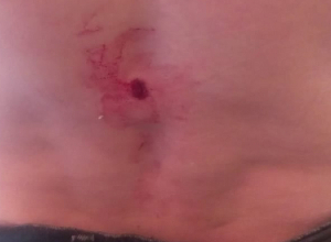 В Храморте снаряд разорвался во дворе дома, житель Арцаха получил осколочное ранение: МВД Арцаха