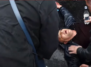 Քաղաքացին ոստիկանների հետ բախման ժամանակ վնասվածք է ստացել