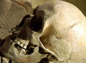 Համալիրի տարածքում ծառատունկի ժամանակ մարդու գանգ են գտել․ shamshyan.com