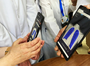 Ճառագայթման նվազագույն մակարդակ ունեցող ռենտգեն սարք` Թոքաբանության ազգային կենտրոնում