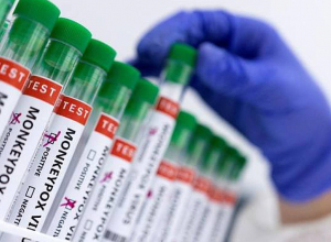 Վրաստանում «Կապիկի ծաղիկ» վիրուսի առաջին դեպքն է գրանցվել