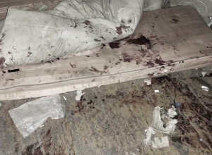 Տաշիրում ծեծի ենթարկված տղամարդը Երևանում մահացել է․  մեկ անձ կալանավորվել է