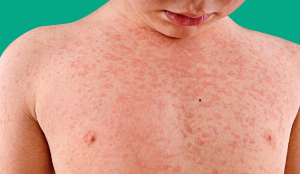 347423380_568711372117404_3763950105301276229_n