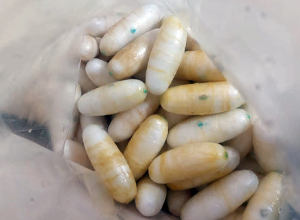 Բրազիլիայից Հայաստան ժամանած ուղեւորի աղիներում 300 հազար դոլարի կոկաին են հայտնաբերել