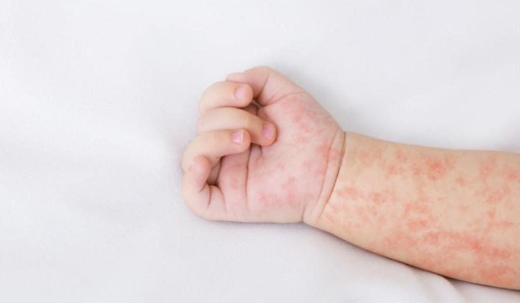 394631826_639336345054906_8598295744505357842_n