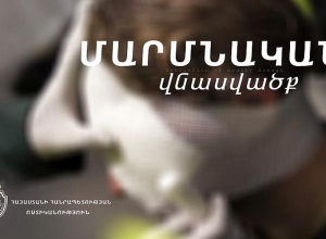 Ձեռնափայտով հարվածել էր 91-ամյա հորը, ապա գրպանից փող էր հափշտակել