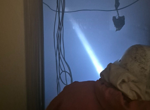 Հրդեհ` Երևանի բժշկական կենտրոններից մեկի մարտկոցների սենյակում