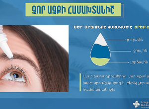 Որոնք են չոր աչքի հիվանդության հիմնական նշանները
