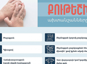 Վերջին 2 ամիսներին նկատվում է քութեշով պայմանավորված հիվանդացության ակտիվություն