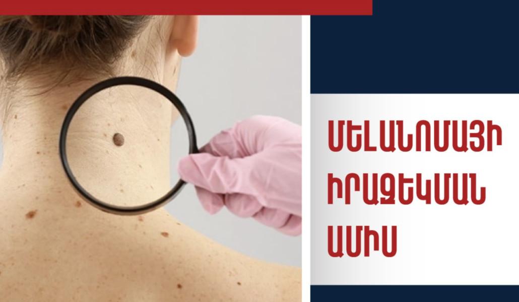 495931677_1006326658355871_9208555863661601969_n