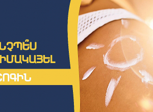 Ինչպես դիմակայել շոգին